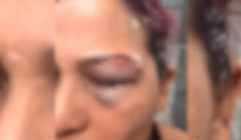 Lutadora denuncia ex-companheiro após ser agredida em Manaus