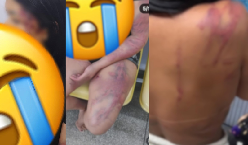 Mulher denuncia agressões do ex-namorado e da mãe dele em Manaus